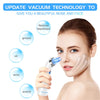 Blackhead Remover,  Pore Vacuum Facial Cleanser, Electric Acne Remover