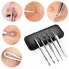 Y.F.M Blackhead Remover Kit Pimple Comedone Extractor Tool Acne Removal Set With Mirror